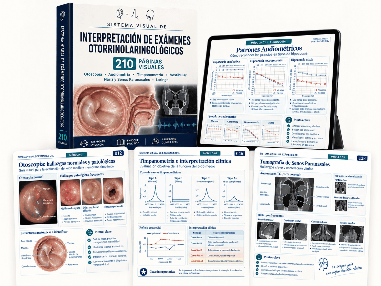 Vista previa del Sistema Visual de Interpretación de Exámenes Otorrinolaringológicos